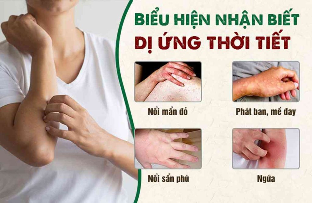 dị ứng thời tiết